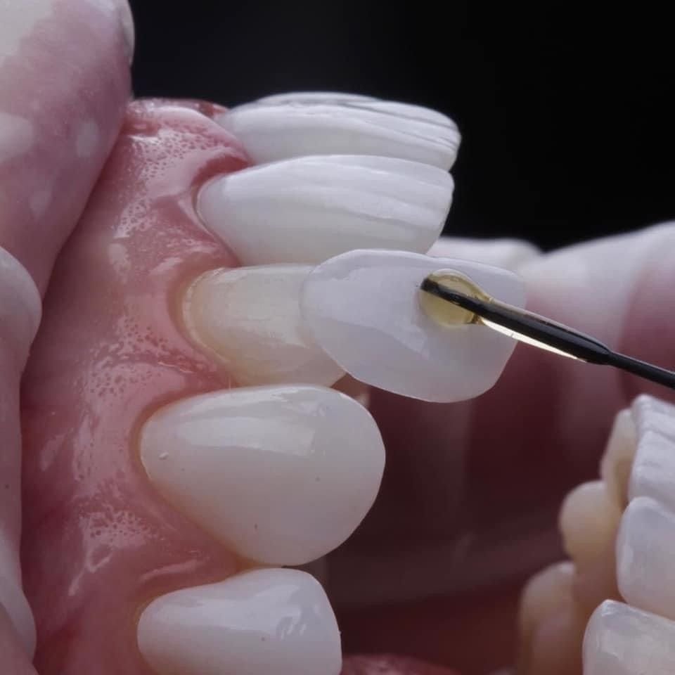 Cosmetic dentistry